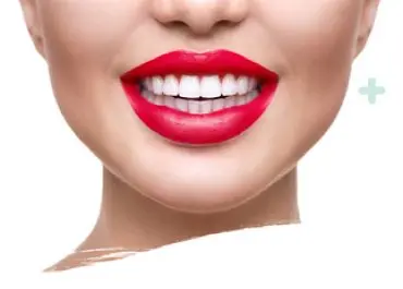 Sonrisa perfecta resultado de tratamiento estético dental